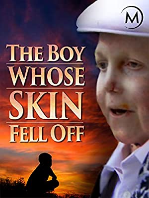 The Boy Whose Skin Fell Off (2004) starring Edna Kennedy on DVD on DVD